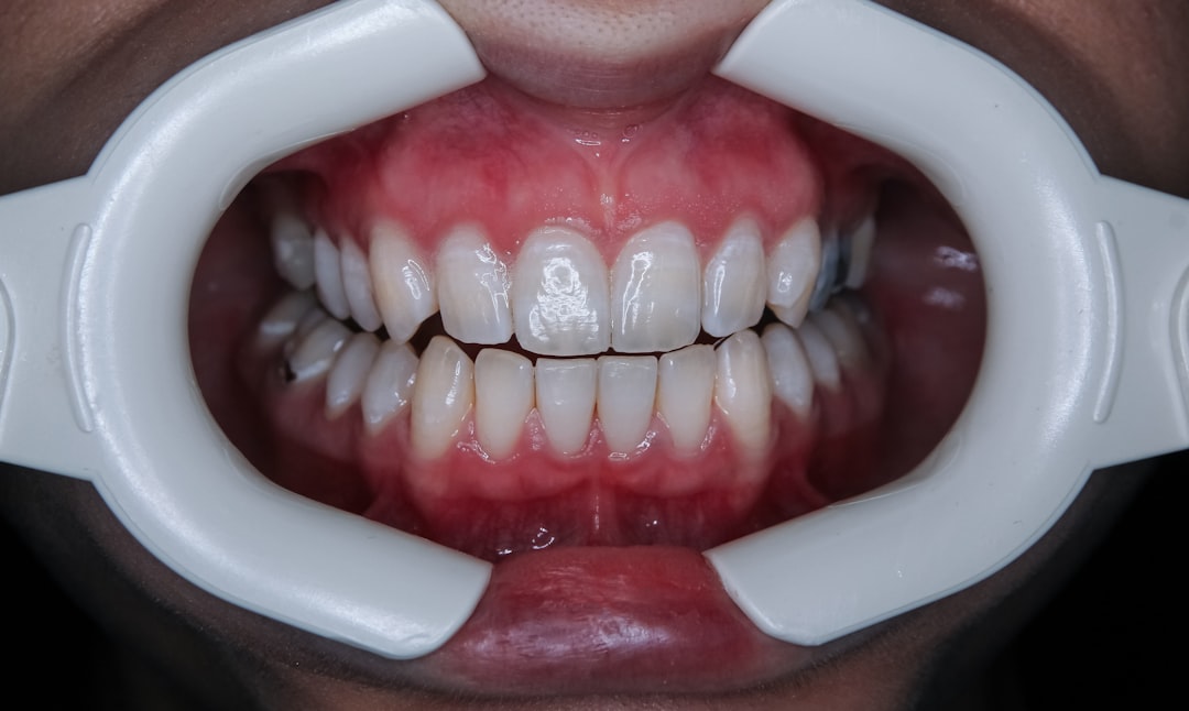 Woman cleaning teeth with electric toothbrush iTero Lumina - Intraoralscanner - Hamburg Innenstadt