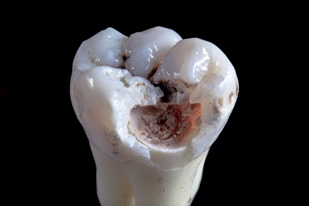 iTero Lumina - Intraoralscanner - Hamburg Innenstadt