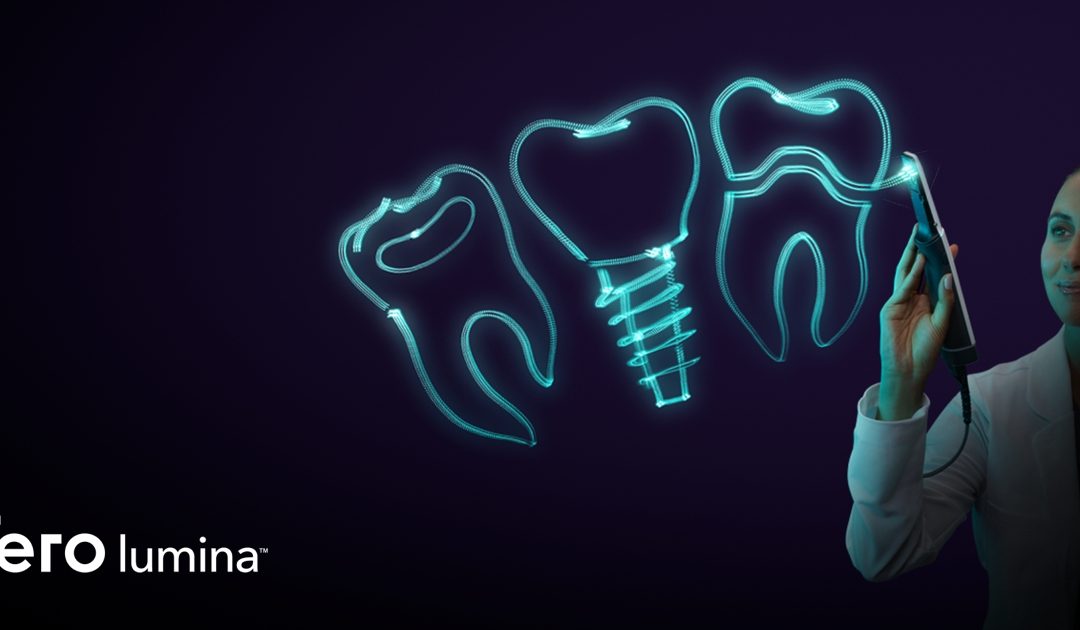 iTero LuminaTM – Intraoralscanner statt Abdrucklöffel