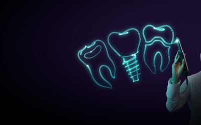 iTero LuminaTM – Intraoralscanner statt Abdrucklöffel