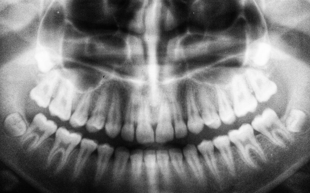 Knochenuntersuchungen in der Zahnmedizin: Wann sind Röntgen, CT oder MRT sinnvoll?