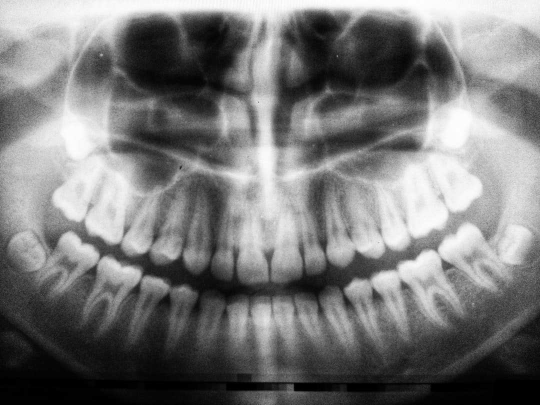 Woman cleaning teeth with electric toothbrush iTero Lumina - Intraoralscanner - Hamburg Innenstadt