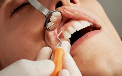 Paraprobiotika als Unterstützung der Parodontaltherapie: Neue Erkenntnisse aus einer klinischen Studie